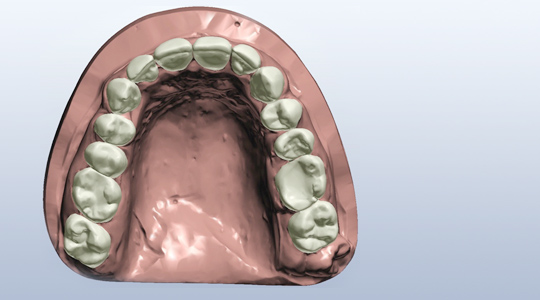 Kieferorthop&auml;die